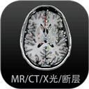 影像解剖图谱