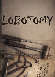脑叶切除术(Lobotomy)